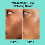 DR. JART+ – Pore Remedy PHA Exfoliating Serum - Image 6