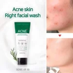 SOME BY MI – AHA BHA PHA 30 Days Miracle Acne Clear Foam - Image 2