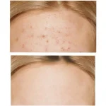 SOME BY MI – AHA BHA PHA 30 Days Miracle Cream | Clear Skin - Image 2