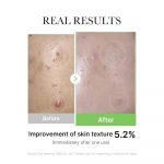 MEDICUBE – Exosome Cica Ampoule | Redness Relief Serum - Image 5