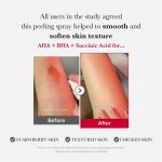 MEDICUBE – Red Acne Body Peeling Shot | Breakout Clearing - Image 2