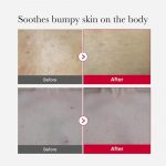 MEDICUBE – Red Acne Body Peeling Shot | Breakout Clearing - Image 5