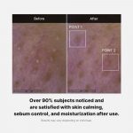 MEDICUBE – Red Foam Cleanser | Acne-Control, Sebum-Balancing - Image 4