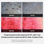 MEDICUBE – Red Succinic Acid Peeling Pad | Acne-Fighting - Image 5