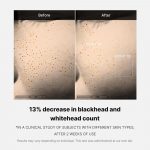 MEDICUBE – Zero Pore One Day Serum | Pore-Refining - Image 5