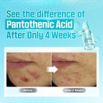 NUMBUZIN – No.1 Pantothenic B5 Active Soothing Serum - Image 8