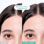 BRING GREEN – Tea Tree Cica Soothing Cream | Skin Calming - Image 4