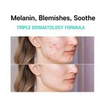 CARE:NEL – Anti-Melasma Cica Cream | Brightening Cream - Image 10