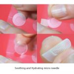 CURESYS – Trouble Clear Needle Patch | Acne Treatment Patch - Image 9