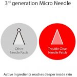 CURESYS – Trouble Clear Needle Patch | Acne Treatment Patch - Image 8