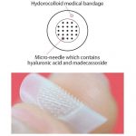 CURESYS – Trouble Clear Needle Patch | Acne Treatment Patch - Image 6
