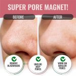 LOOK AT ME – Nose Pore Strips Charcoal | Blackhead Removal - Image 2