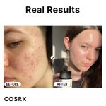 COSRX – The Niacinamide 15 Serum | Pore-Refining Brightening - Image 7