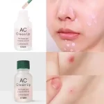 ETUDE – AC Clean Up Pink Powder Spot | Overnight Fix - Image 3
