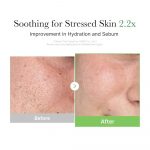 MEDICUBE – Exosome Cica Cream | Barrier Repair Moisturizer - Image 6