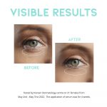 OOTD – Wrinkle Lift Eye Serum | Anti-Aging, Firming - Image 5