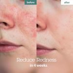 BLITHE – Crystal Iceplant Pressed Serum | Cooling Glow - Image 5