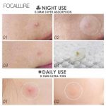 FOCALLURE – Acne Pimple Patch – #2 Night - Image 7