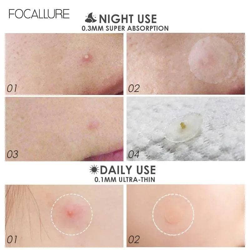 Focallure – acne pimple patch – #2 night - image 7