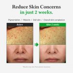 Dr. Althea - Gentle Vitamin C Serum | Hydrating Brightening - Image 5