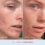 FIRST AID BEAUTY – Ultra Repair Cream Intense Hydration - Image 5