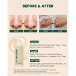KSECRET - SEOUL 1988 Cleansing Oil Pine Cica 1% + Probiotics - Image 7