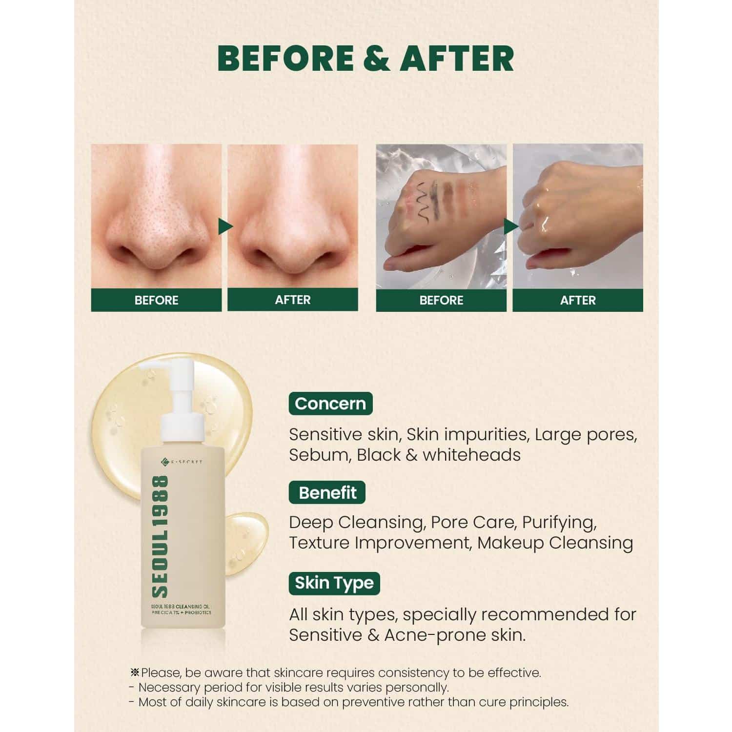 Ksecret - seoul 1988 cleansing oil pine cica 1% + probiotics - image 7