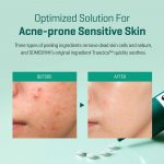 SOME BY MI – AHA BHA PHA 14 Days Super Miracle Spot All Kill Cream - Image 5
