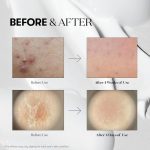 VT COSMETICS – Reedle Shot 100 | Skin Renewal - Image 6