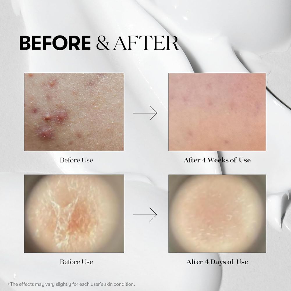 Vt cosmetics – reedle shot 100 | skin renewal - image 6