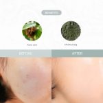 DR. ALTHEA – Last Minute Skin Rescue Anastatica Mask - Image 4