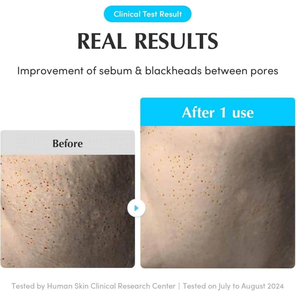 Eqqualberry – swimming pool toner pads | hydrating, soothing - image 6