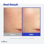 ISNTREE – Hyaluronic Acid Aqua Gel Cream | Hydrating - Image 8