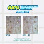 JUMISO – Blackhead Melting Softener & Cotton Pad Set - Image 8