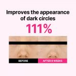 ISOI – Blemish Care Eye & Wrinkle Patch | Hydrating, Firming - Image 7