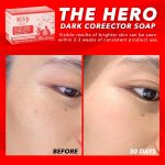 KOJI WHITE – Kojic Acid Dark Spot Corrector Soap - Image 2