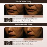 MARSHIQUE – Line Lifting Hydrogel Smile Line Patch - Image 7