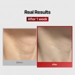 MEDITHERAPY – Collagen Wrinkle-Fit Neck Mask - Image 9