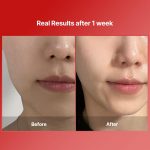 MEDITHERAPY – Shumage Gold Seal Wrapping Mask | Anti-Aging - Image 7
