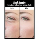 MEDITHERAPY – Botalinum Ampoule | Anti-Aging, Firming - Image 5