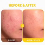 TIRTIR – Pure Vitamin C24 Serum | Brightening, Anti-Aging - Image 3